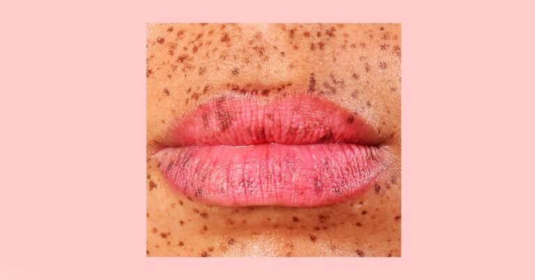 Lips_Closeup-1200x628-Facebook.jpg